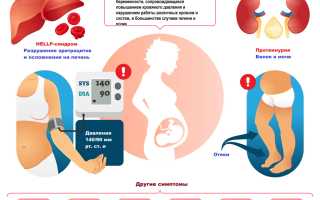 Что такое преэклампсия во время беременности? Важные аспекты и последствия