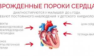 Врожденный порок сердца: признаки, причины, продолжительность жизни и лечение