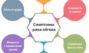 Симптомы и лечение мелкоклеточного рака легких: важные аспекты