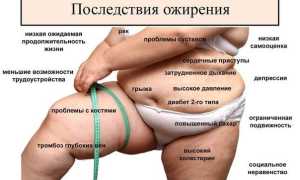 Почему происходит гормональное ожирение? Причины и последствия