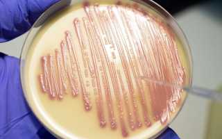 E. coli (кишечная палочка): чем она опасна для здоровья?