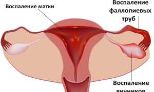 Месячные идут 2 дня — нормально ли это для здоровья женщины?