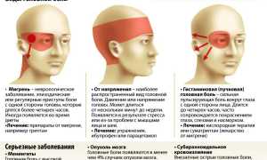Почему болит затылок головы? Причины и рекомендации