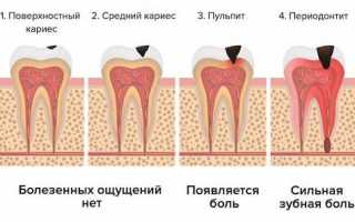 Почему зубы начинают болеть от холода? Узнайте причины и решения
