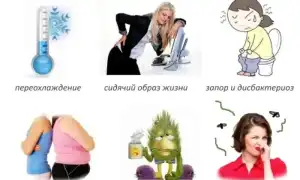 Кто лечит цистит у женщин? Полезная информация и советы