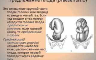 Предлежание головка это как