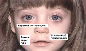 Фетальный алкогольный синдром и его причины: важные аспекты