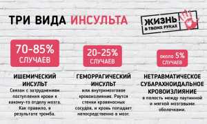 Виды инсульта: их различия и признаки для диагностики