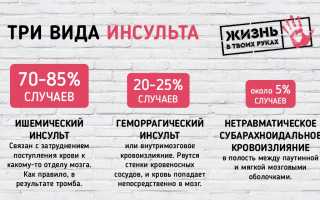 Виды инсульта: их различия и признаки для диагностики