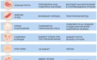 Псориаз и экзема: в чем разница между ними и их особенностями?