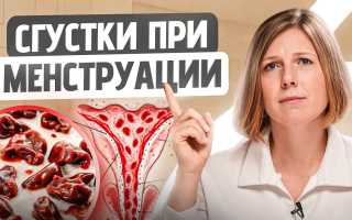 Месячные со сгустками крови — почему это происходит и что делать?