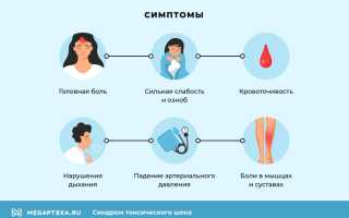 Что такое синдром токсического шока, причины и лечение: важная информация для здоровья