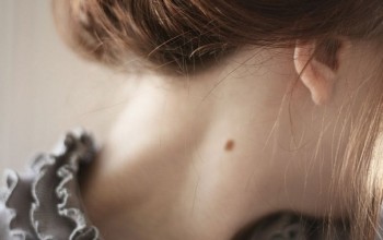 Родинки на шее у женщин Родинки на шее у женщин