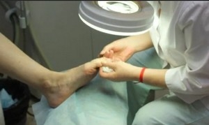 Хирургическое удаление