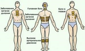 Перцовый пластырь