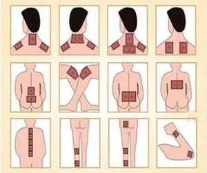 Перцовый пластырь