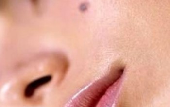 Родинки на щеке у женщин Родинки на щеке у женщин
