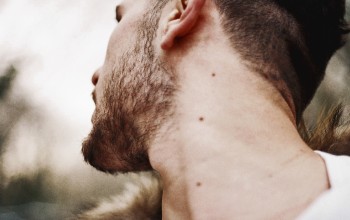 Родинки на шее у мужчин Родинки на шее у мужчин