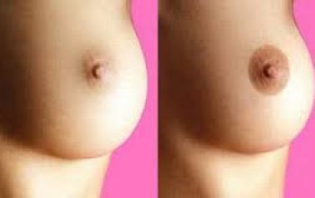 Родинки на соске Родинки на соске