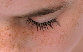 Юношеские плоские родинки Юношеские плоские родинки