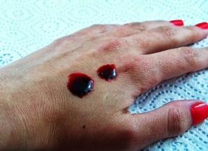 вязкость крови